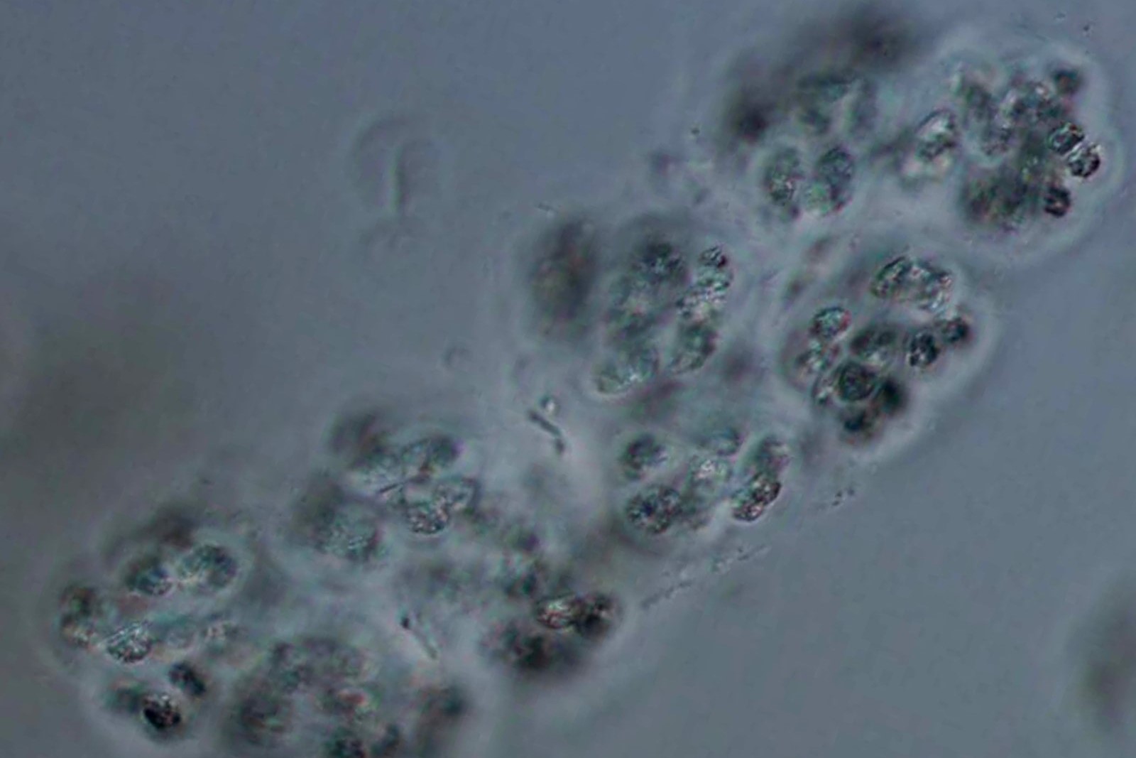 Light micrograph image of Microcystis virdis